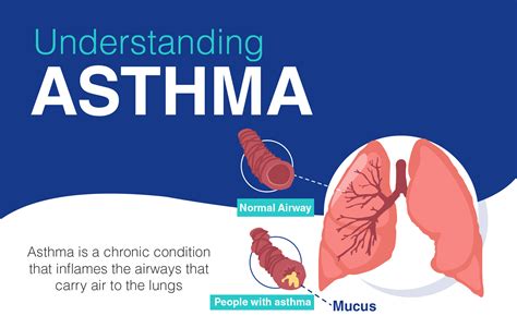 What Causes Asthma Attacks In Your Sleep